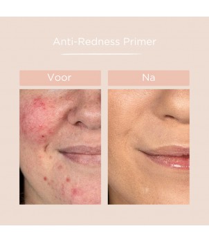 Anti Redness Primer